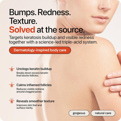 Advanced Triple-Acid Complex for Keratosis Pilaris