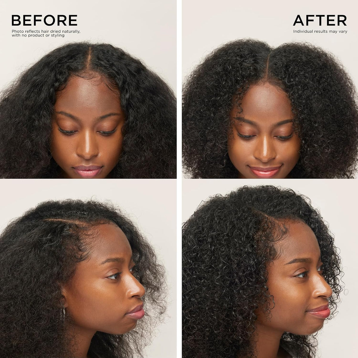 Dr. Groot Scalp Revitalizing Solution Regrowth Bundle